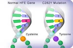 HFE Gene Mutation