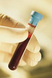 tube-of-blood-in-hand